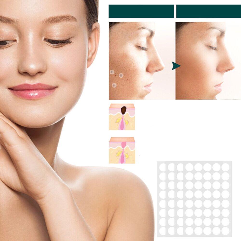 SkinClear - patch for removal of marks and warts