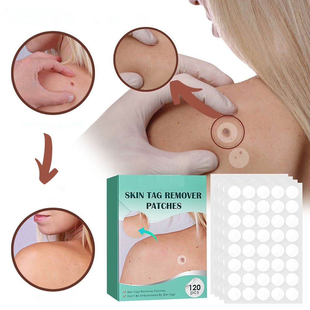 SkinClear - patch for removal of marks and warts