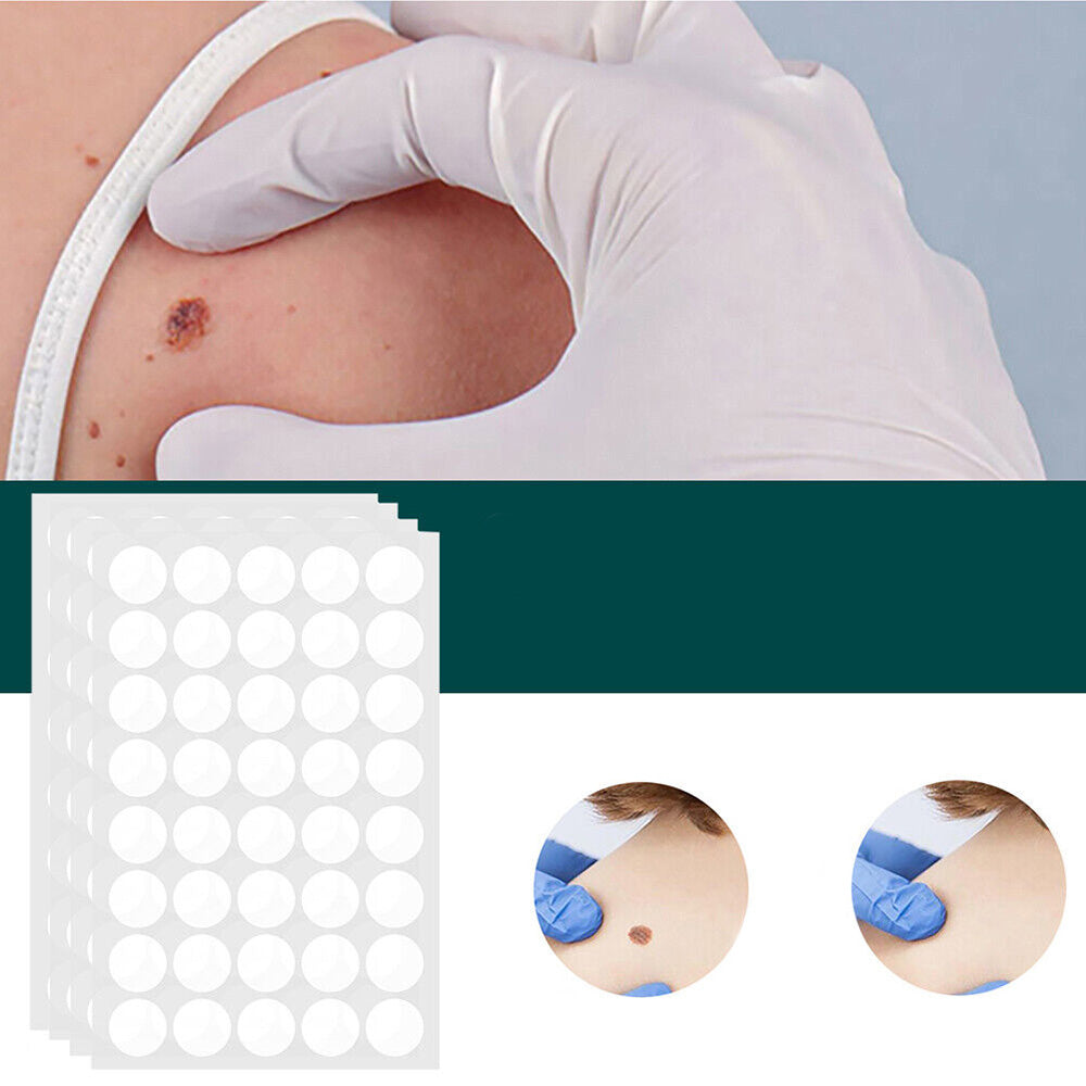 SkinClear - patch for removal of marks and warts