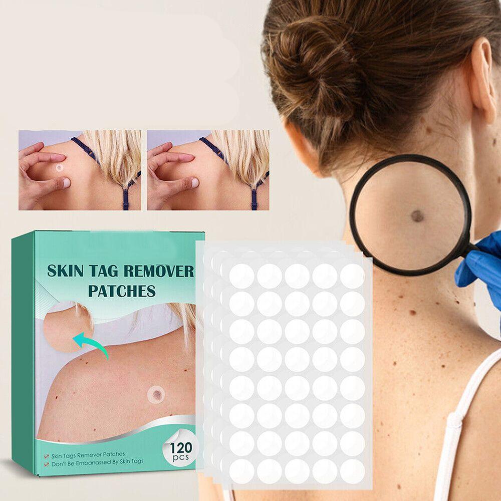 SkinClear - patch for removal of marks and warts